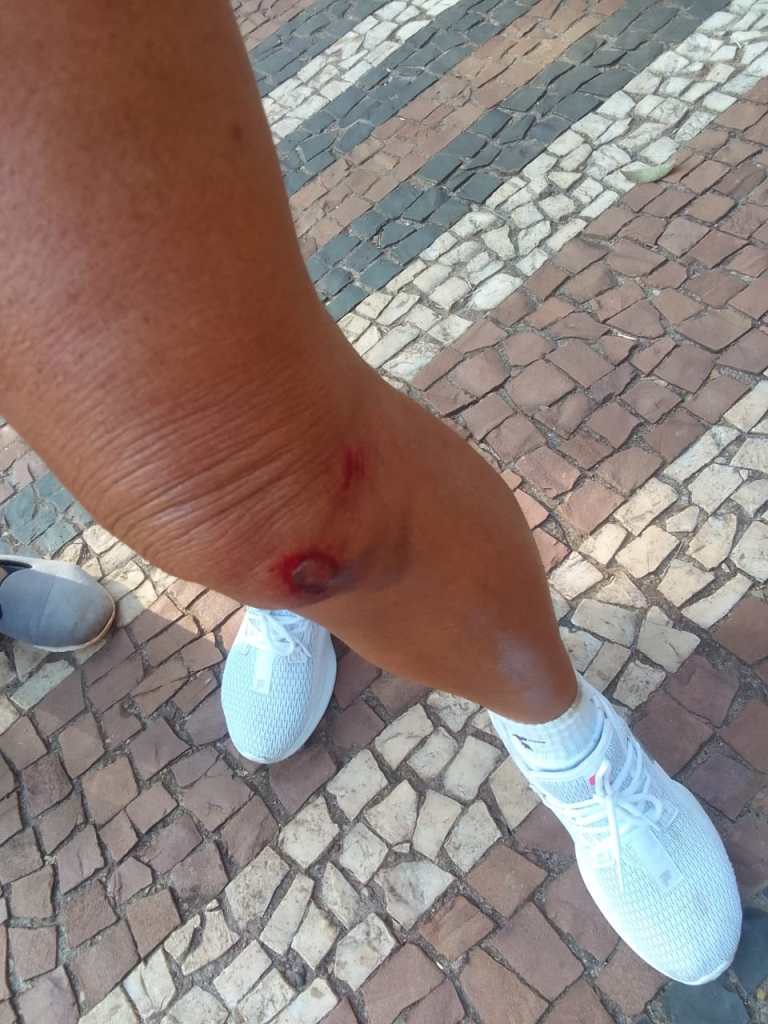 Mulher teve ferimentos depois de tombo na calçada do Parque do Bicão