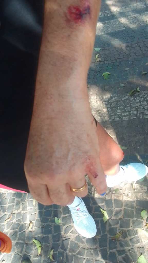 Mulher teve ferimentos depois de tombo na calçada do Parque do Bicão