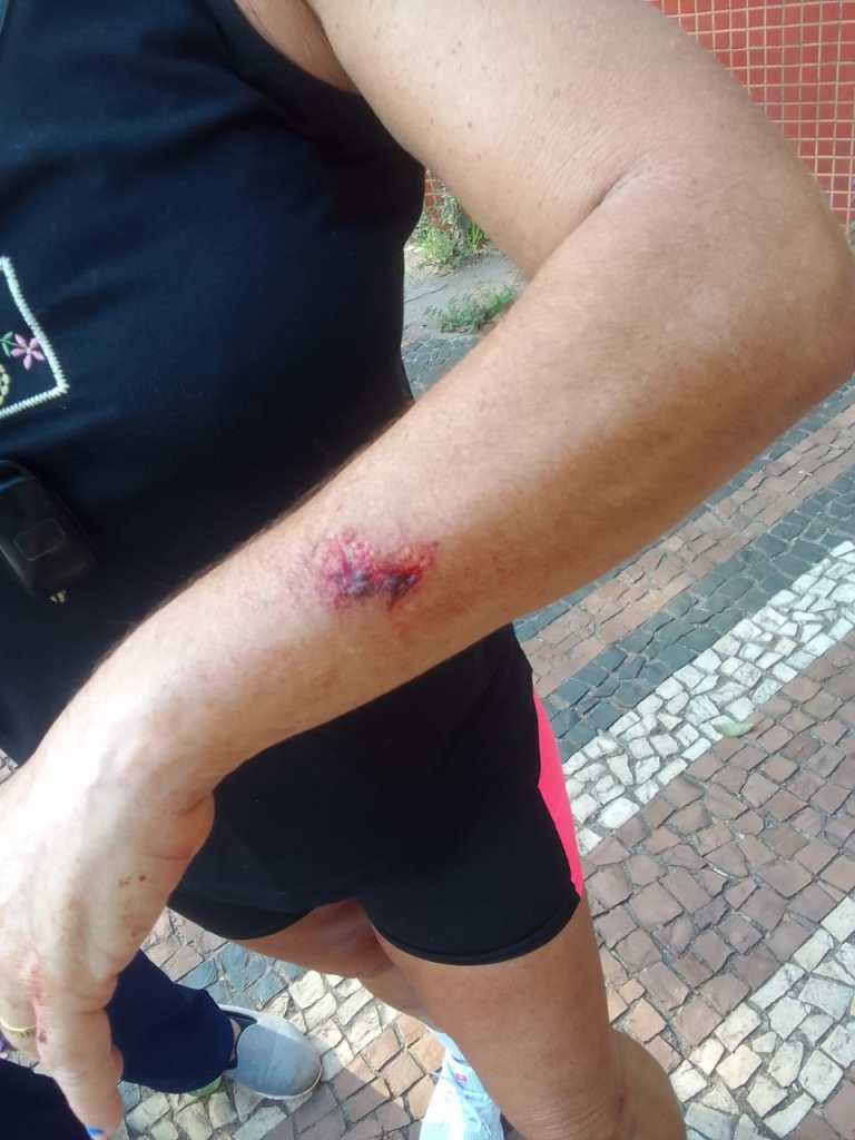 Mulher levou tombo em calçada do Parque do Bicão