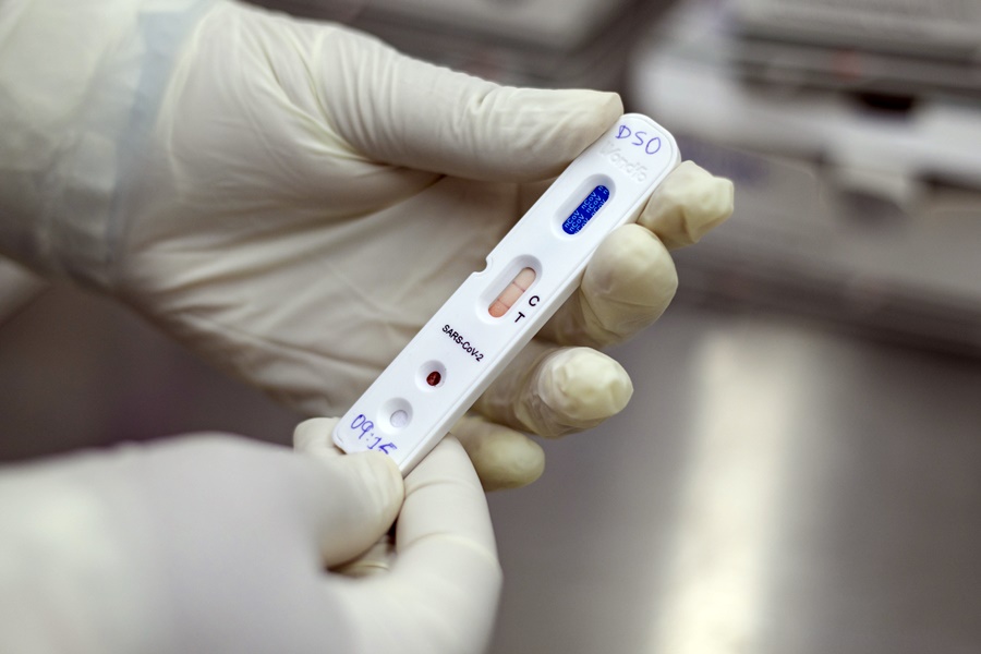 TESTE RAPIDO PARA DETECCAO DE ANTICORPOS CONTRA SARS-CoV-2;CORONAVIRUS;COVID19;SAUDE;SESA;GOVERNO DO CEARA;MEDIDAS DE COMBATE DE COVID-19; FOTO © JOSE WAGNER/ GOV. DO CEARA