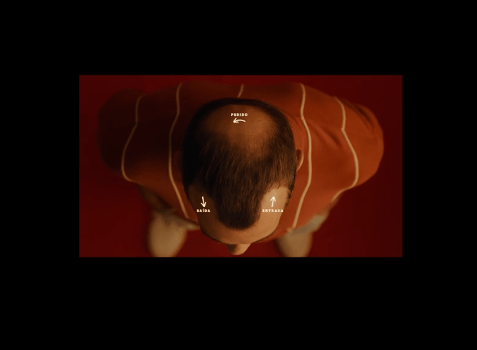 Calvície vale um Whopper no BK Calvície vale um Whopper no BK