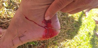 Piranhas atacam no Broa durante o Carnaval e Prefeitura de Itirapina lamenta