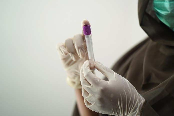 Projeto desenvolvido em São Carlos visa baratear produção de medicamento para o câncer Projeto desenvolvido em São Carlos visa baratear produção de medicamento para o câncer