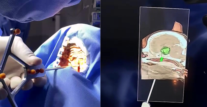 img-neuronavedaor-SVCOM-EESC DNA USP: Startup criada em laboratório da EESC desenvolve neuronavegador que auxilia em cirurgias veterinárias