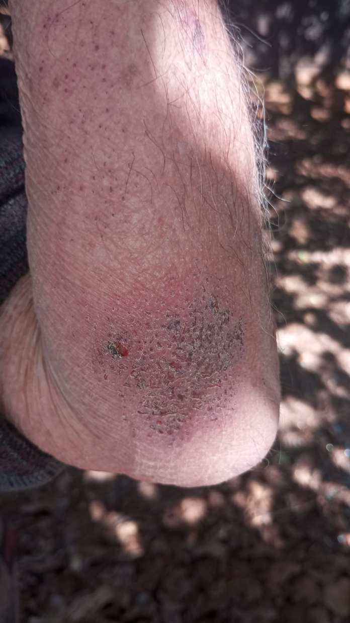 Idoso teve ferimentos nos braços