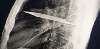 Surreal: faca dentro do corpo