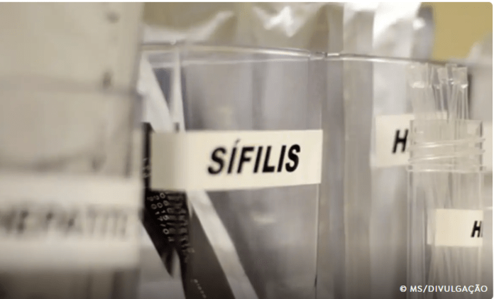 Sífilis continua em ritmo acelerado de crescimento no país