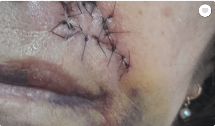 Vakinha para tratamento de câncer Vakinha para tratamento de câncer