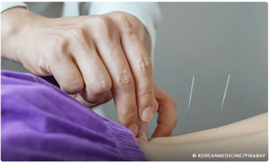 Trabalho do profissional de acupuntura no Brasil é regulamentado por Lula