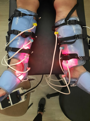 Pesquisadores do IFSC/USP abrem segunda chamada para tratamento experimental de lipedema