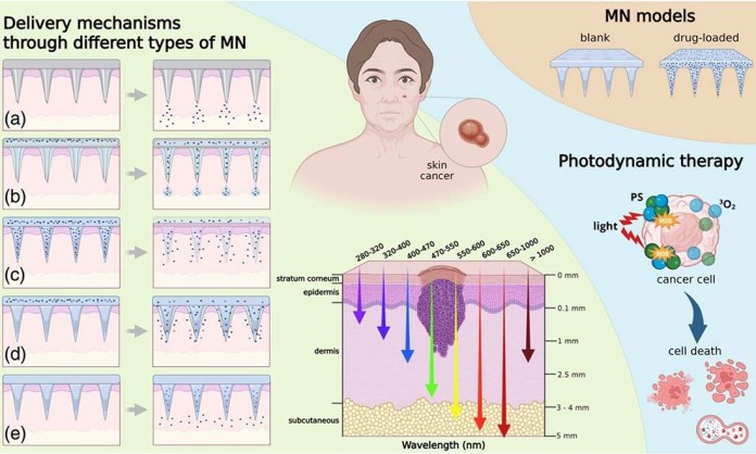 Para a primeira autora da pesquisa publicada no Journal of Biomedical Optics, Drª Michelle Requena, que concluiu seu mestrado, doutorado e pós-doutorado no Instituto de Física de São Carlos (IFSC/USP) e que atualmente realiza um novo pós-doutorado no Departamento de Engenharia Biomédica da Texas AM University (EUA) “É muito gratificante ver esse trabalho ganhar visibilidade, especialmente por representar a evolução de uma linha de pesquisa iniciada em 2017 durante o meu doutorado”, Para a primeira autora da pesquisa publicada no Journal of Biomedical Optics, Drª Michelle Requena, que concluiu seu mestrado, doutorado e pós-doutorado no Instituto de Física de São Carlos (IFSC/USP) e que atualmente realiza um novo pós-doutorado no Departamento de Engenharia Biomédica da Texas AM University (EUA) “É muito gratificante ver esse trabalho ganhar visibilidade, especialmente por representar a evolução de uma linha de pesquisa iniciada em 2017 durante o meu doutorado”,