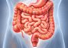 Em 13 anos, casos de doença inflamatória intestinal cresce 5 vezes no Brasil Em 13 anos, casos de doença inflamatória intestinal cresce 5 vezes no Brasil