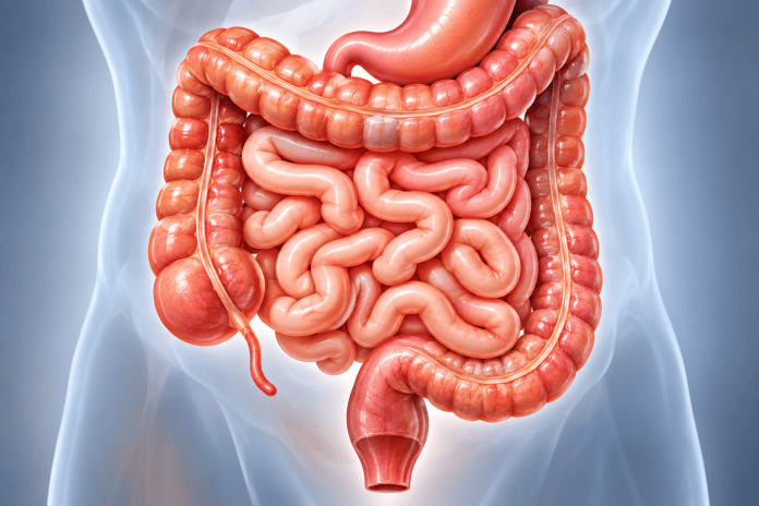 Em 13 anos, casos de doença inflamatória intestinal cresce 5 vezes no Brasil Em 13 anos, casos de doença inflamatória intestinal cresce 5 vezes no Brasil